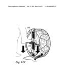 ANTI SLIP DEVICE FOR A WHEEL AND A METHOD FOR MOUNTING THE ANTI SLIP     DEVICE diagram and image