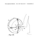 ANTI SLIP DEVICE FOR A WHEEL AND A METHOD FOR MOUNTING THE ANTI SLIP     DEVICE diagram and image