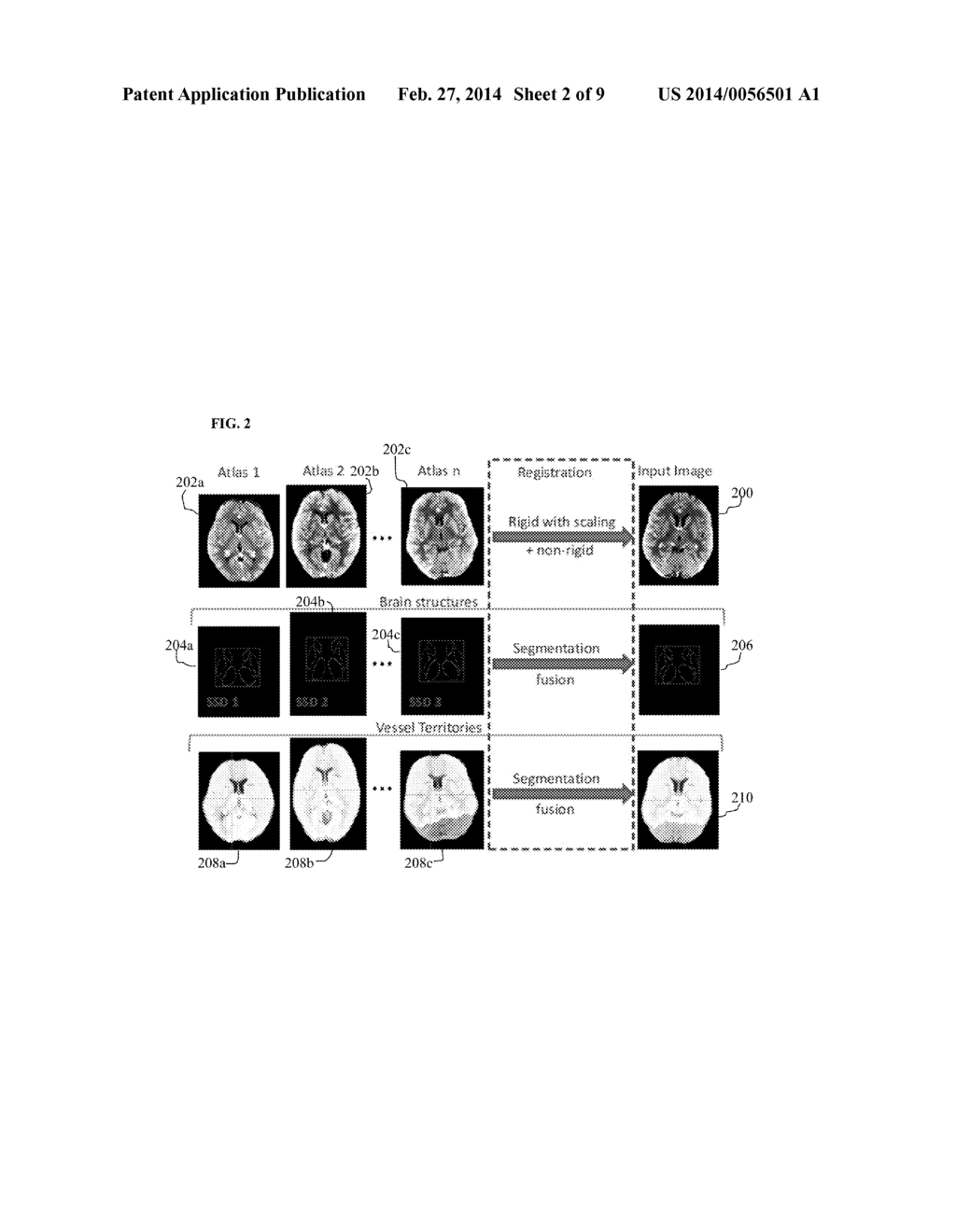 Method and System for Multi-Atlas Segmentation of Brain Computed     Tomography Image Data - diagram, schematic, and image 03