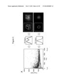 LARGE ONCOSOMES IN HUMAN TUMORS AND IN CIRCULATION IN PATIENTS WITH CANCER diagram and image