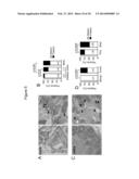 LARGE ONCOSOMES IN HUMAN TUMORS AND IN CIRCULATION IN PATIENTS WITH CANCER diagram and image