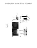 LARGE ONCOSOMES IN HUMAN TUMORS AND IN CIRCULATION IN PATIENTS WITH CANCER diagram and image