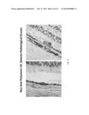 NEOANTIBODIES FOR DIAGNOSING TISSUE INJURY diagram and image