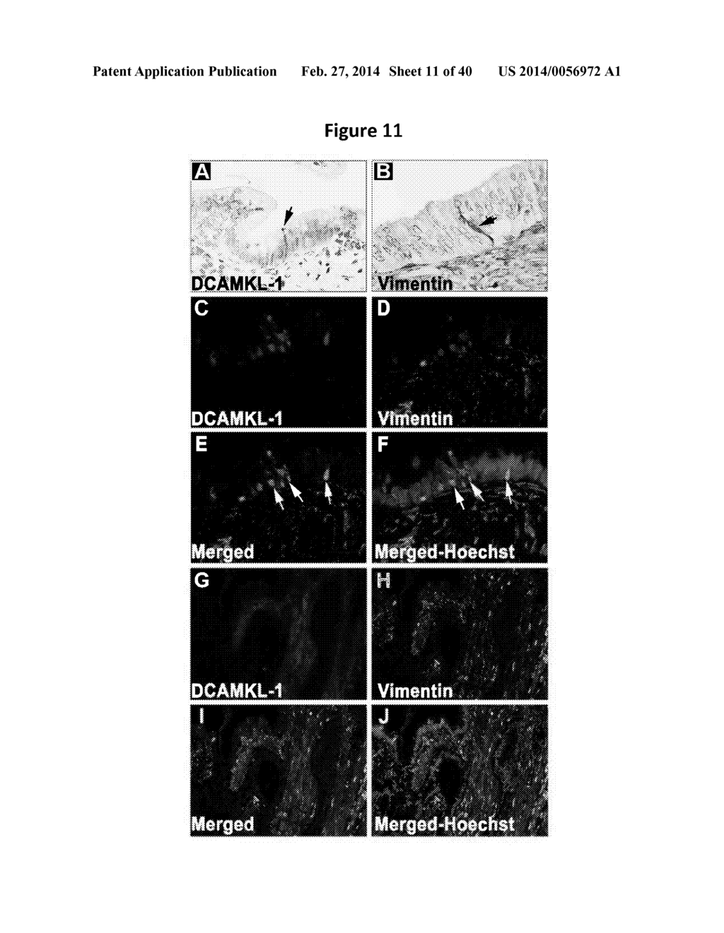 ANTI-DCLK1 MONOCLONAL ANTIBODIES AND METHODS OF PRODUCTION AND USE THEREOF - diagram, schematic, and image 12