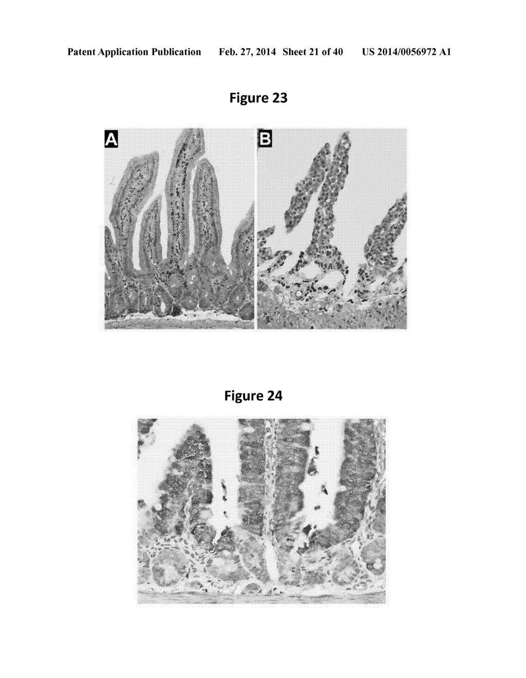 ANTI-DCLK1 MONOCLONAL ANTIBODIES AND METHODS OF PRODUCTION AND USE THEREOF - diagram, schematic, and image 22