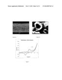 BATTERIES diagram and image