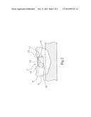 SURGICAL TEMPLATE POSITIONING DEVICE diagram and image