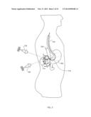 ENERGETIC MODULATION OF NERVES diagram and image