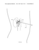 ENERGETIC MODULATION OF NERVES diagram and image