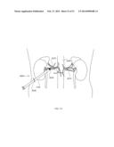 ENERGETIC MODULATION OF NERVES diagram and image