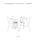 ENERGETIC MODULATION OF NERVES diagram and image