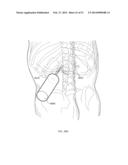 ENERGETIC MODULATION OF NERVES diagram and image