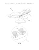 ENERGETIC MODULATION OF NERVES diagram and image