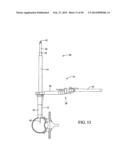 Surgical Access System and Related Methods diagram and image