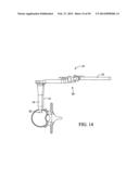 Surgical Access System and Related Methods diagram and image