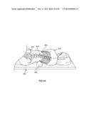 Surgical Access System and Related Methods diagram and image