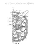 Surgical Access System and Related Methods diagram and image