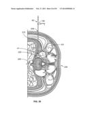 Surgical Access System and Related Methods diagram and image