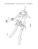 Surgical Access System and Related Methods diagram and image