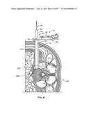 Surgical Access System and Related Methods diagram and image