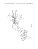 Surgical Access System and Related Methods diagram and image