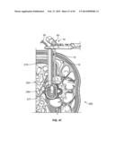 Surgical Access System and Related Methods diagram and image