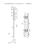 Device, System, and Method for Anatomical Lesion Length Estimation diagram and image