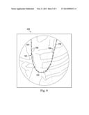 Device, System, and Method for Anatomical Lesion Length Estimation diagram and image