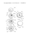 SYSTEMS AND METHODS FOR ANALYSIS AND TREATMENT OF A BODY LUMEN diagram and image