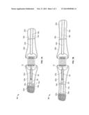 ADJUSTABLE LENGTH ORTHOTIC DEVICE AND METHOD FOR USING THE SAME diagram and image