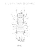 COMPRESSION FOOT GARMENT, AND THERAPEUTIC METHOD FOR REDUCING HEEL PAIN diagram and image