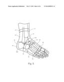 COMPRESSION FOOT GARMENT, AND THERAPEUTIC METHOD FOR REDUCING HEEL PAIN diagram and image