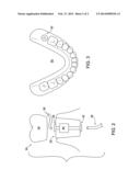 Dental implant device providing intravascular access diagram and image