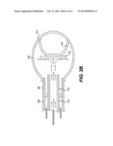 CRYO-ABLATION REFRIGERANT DISTRIBUTION CATHETER diagram and image