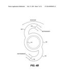 CRYO-ABLATION REFRIGERANT DISTRIBUTION CATHETER diagram and image