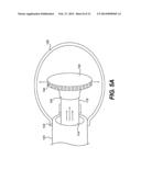 CRYO-ABLATION REFRIGERANT DISTRIBUTION CATHETER diagram and image