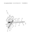 IMPLANT SYSTEM FOR BONE FIXATION diagram and image