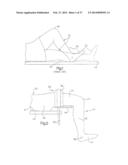 ROBOTIC ARTHROPLASTY SYSTEM INCLUDING NAVIGATION diagram and image