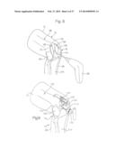 ROBOTIC ARTHROPLASTY SYSTEM INCLUDING NAVIGATION diagram and image