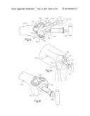 ROBOTIC ARTHROPLASTY SYSTEM INCLUDING NAVIGATION diagram and image