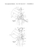 ROBOTIC ARTHROPLASTY SYSTEM INCLUDING NAVIGATION diagram and image