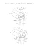 ROBOTIC ARTHROPLASTY SYSTEM INCLUDING NAVIGATION diagram and image