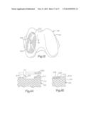 ROBOTIC ARTHROPLASTY SYSTEM INCLUDING NAVIGATION diagram and image