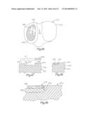 ROBOTIC ARTHROPLASTY SYSTEM INCLUDING NAVIGATION diagram and image