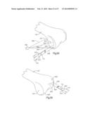 ROBOTIC ARTHROPLASTY SYSTEM INCLUDING NAVIGATION diagram and image