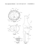 ROBOTIC ARTHROPLASTY SYSTEM INCLUDING NAVIGATION diagram and image