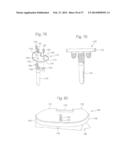 ROBOTIC ARTHROPLASTY SYSTEM INCLUDING NAVIGATION diagram and image