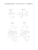 ROBOTIC ARTHROPLASTY SYSTEM INCLUDING NAVIGATION diagram and image