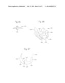 ROBOTIC ARTHROPLASTY SYSTEM INCLUDING NAVIGATION diagram and image