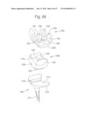 ROBOTIC ARTHROPLASTY SYSTEM INCLUDING NAVIGATION diagram and image